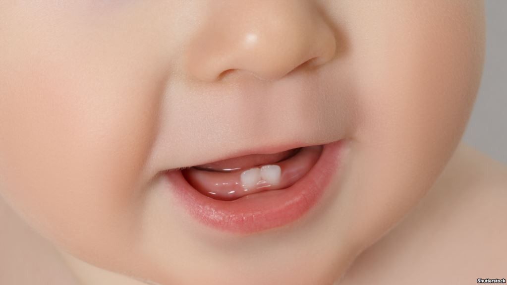 3 حالات تستدعي الذهاب للطبيب عند ظهور الأسنان اللبنية
