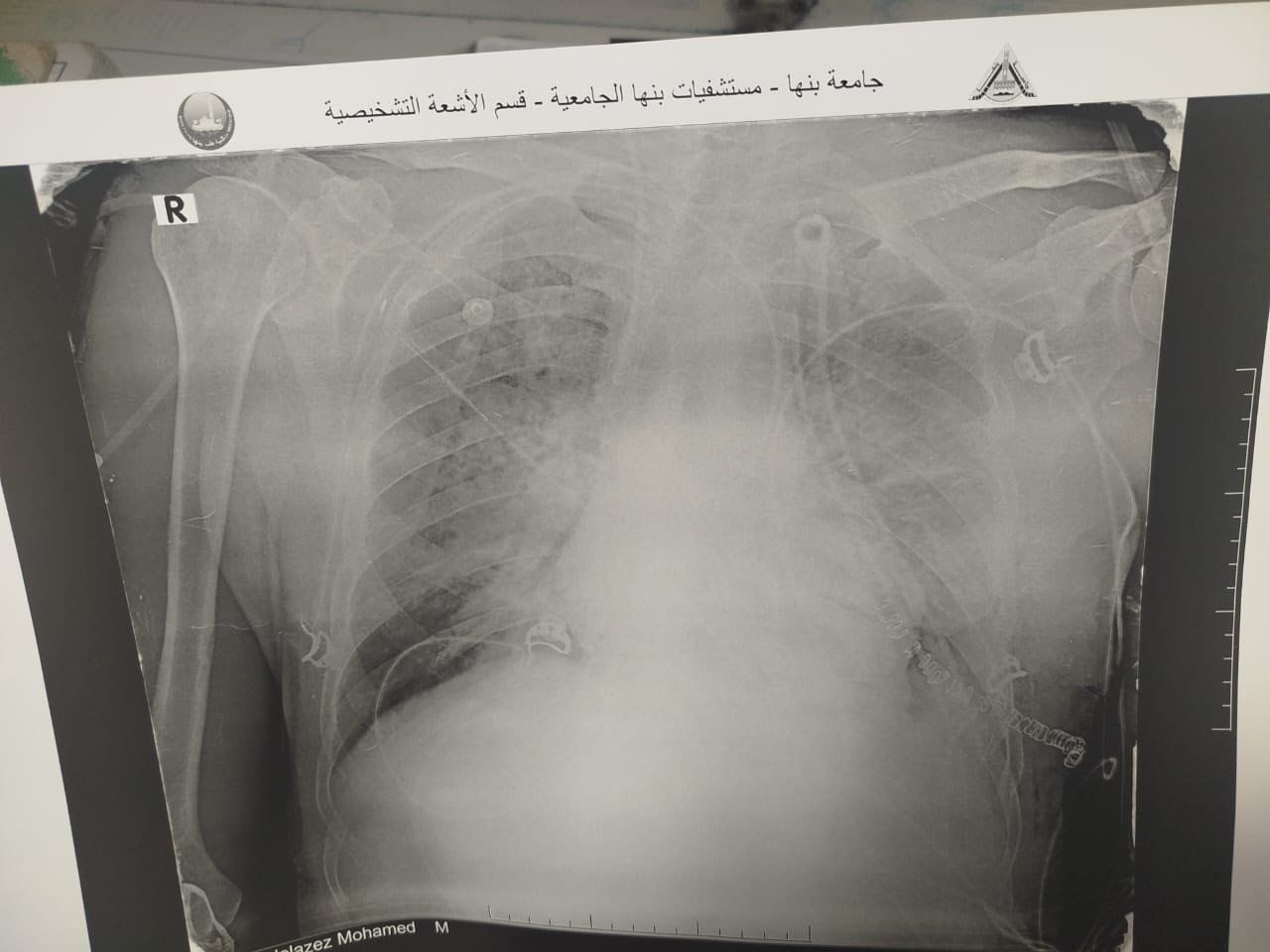 الأشعة الخاصة بالمريض الأشعة الخاصة بالمريض