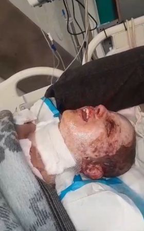 الطفل مجد أبو حبيب