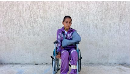 الطفلة المصابة تالا أبو شاويش الطفلة المصابة تالا أبو شاويش