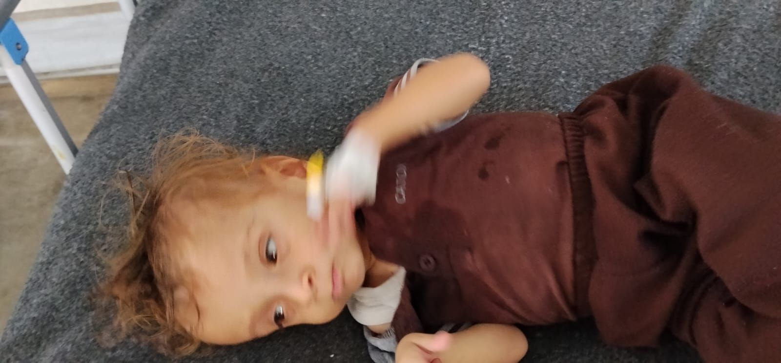 الطفل المصاب محمد أبو طعيمة الطفل المصاب محمد أبو طعيمة