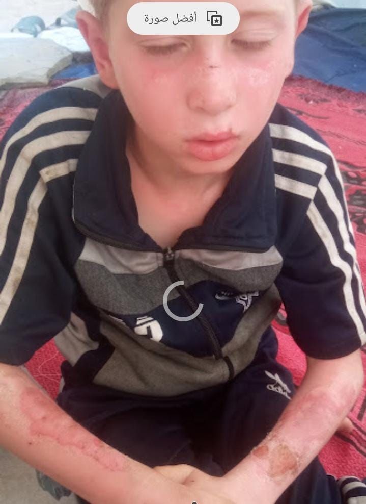 الطفل يزن الطفل يزن