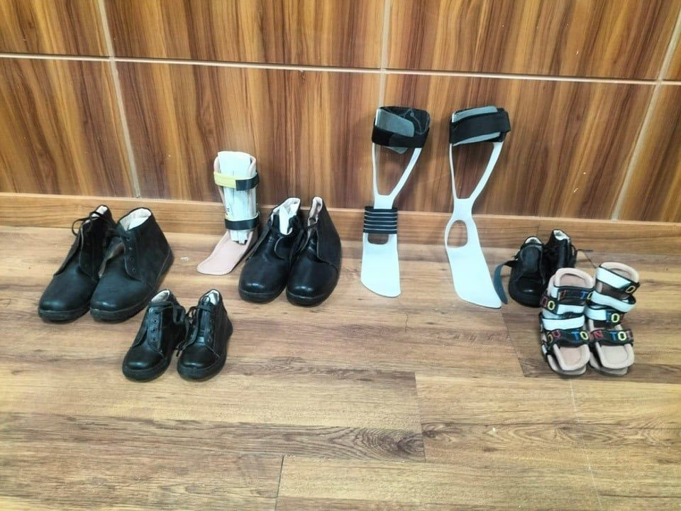 إنهاء قوائم الانتظار وتوفر أطراق وأحذية طبية للمرضي إنهاء قوائم الانتظار وتوفر أطراق وأحذية طبية للمرضي