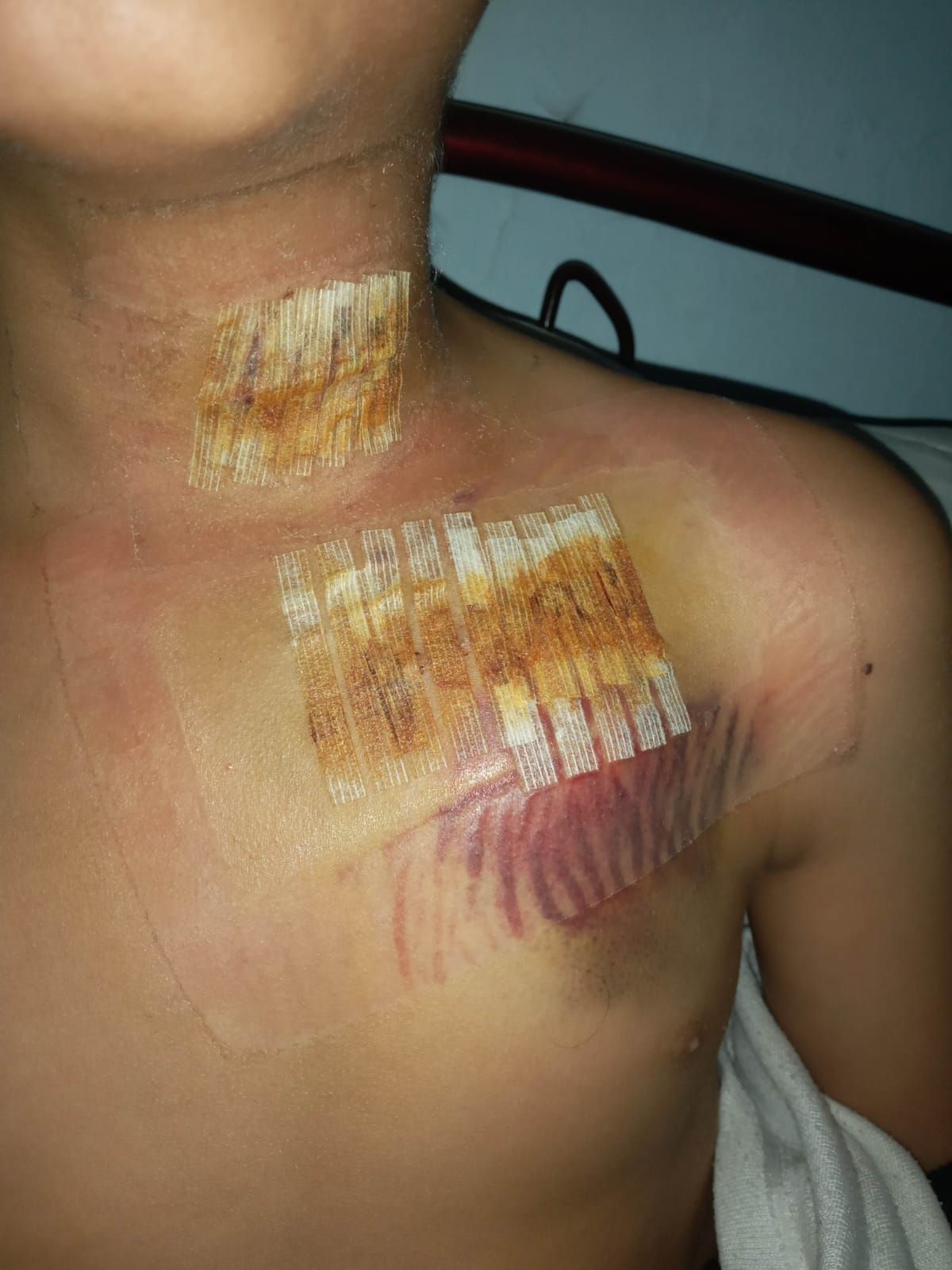 إصابة عبد الله عصفور إصابة عبد الله عصفور