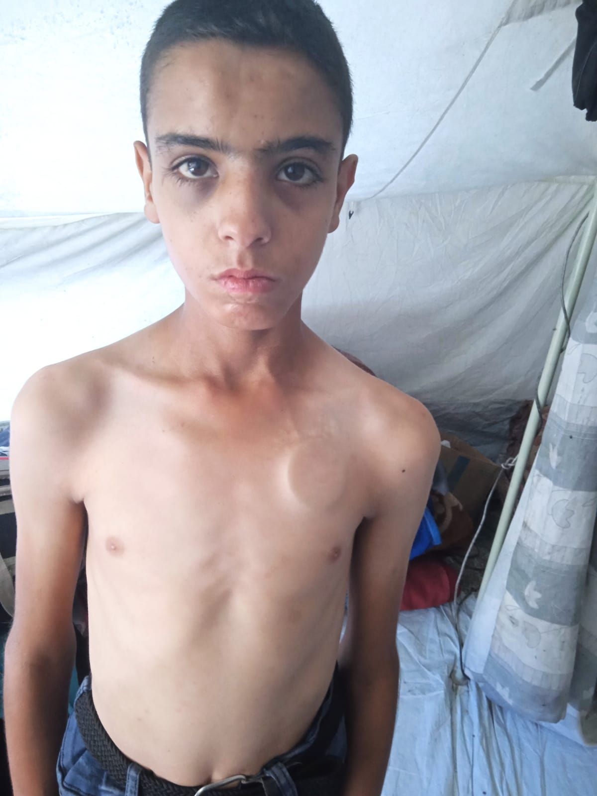 الطفل عبد الله عصور الطفل عبد الله عصور