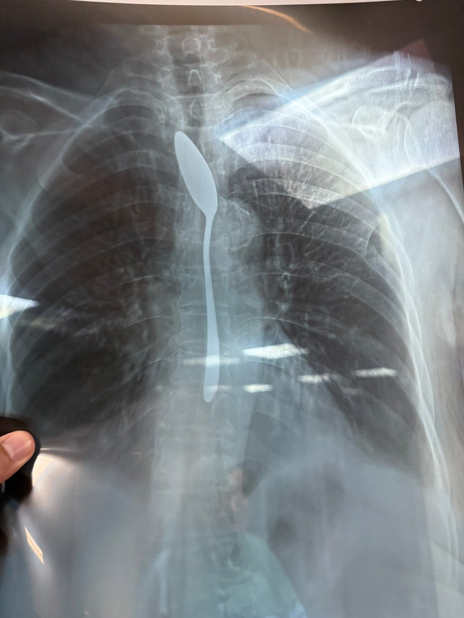 الاشاعة الاشاعة