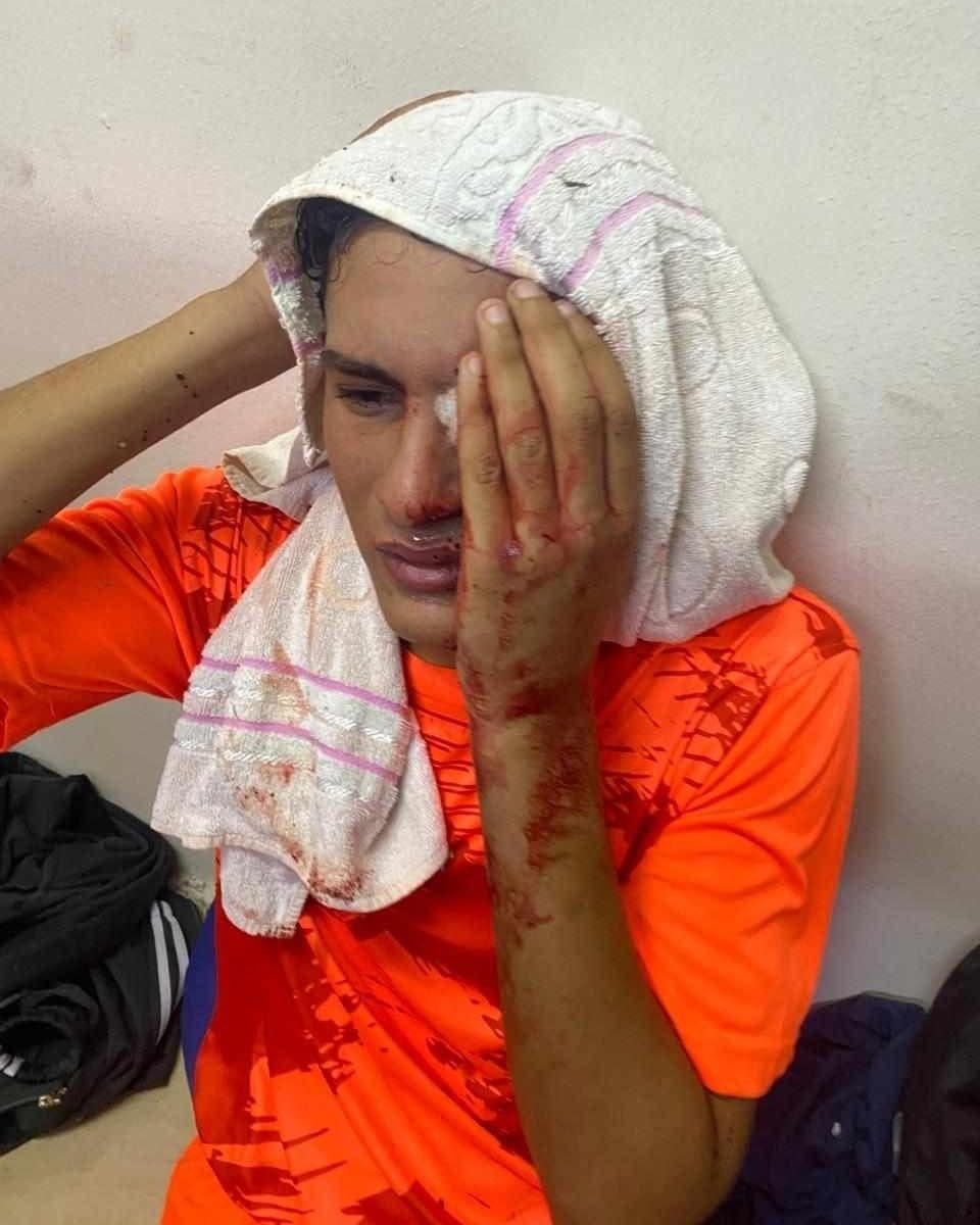 لاعب أبو قير المصاب