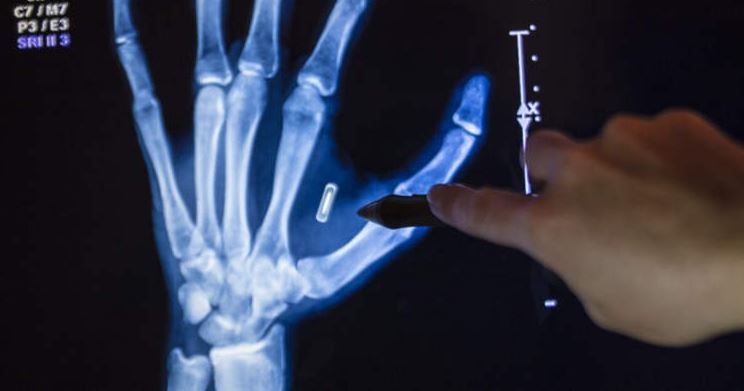 شريحة داخل جسم ساحر شريحة داخل جسم ساحر