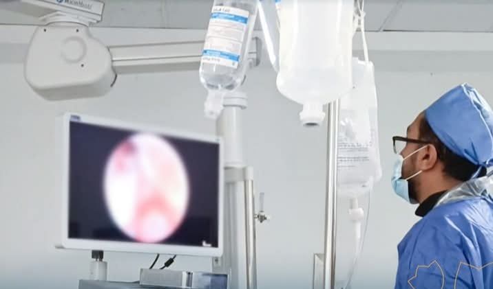 احدث المناظير احدث المناظير