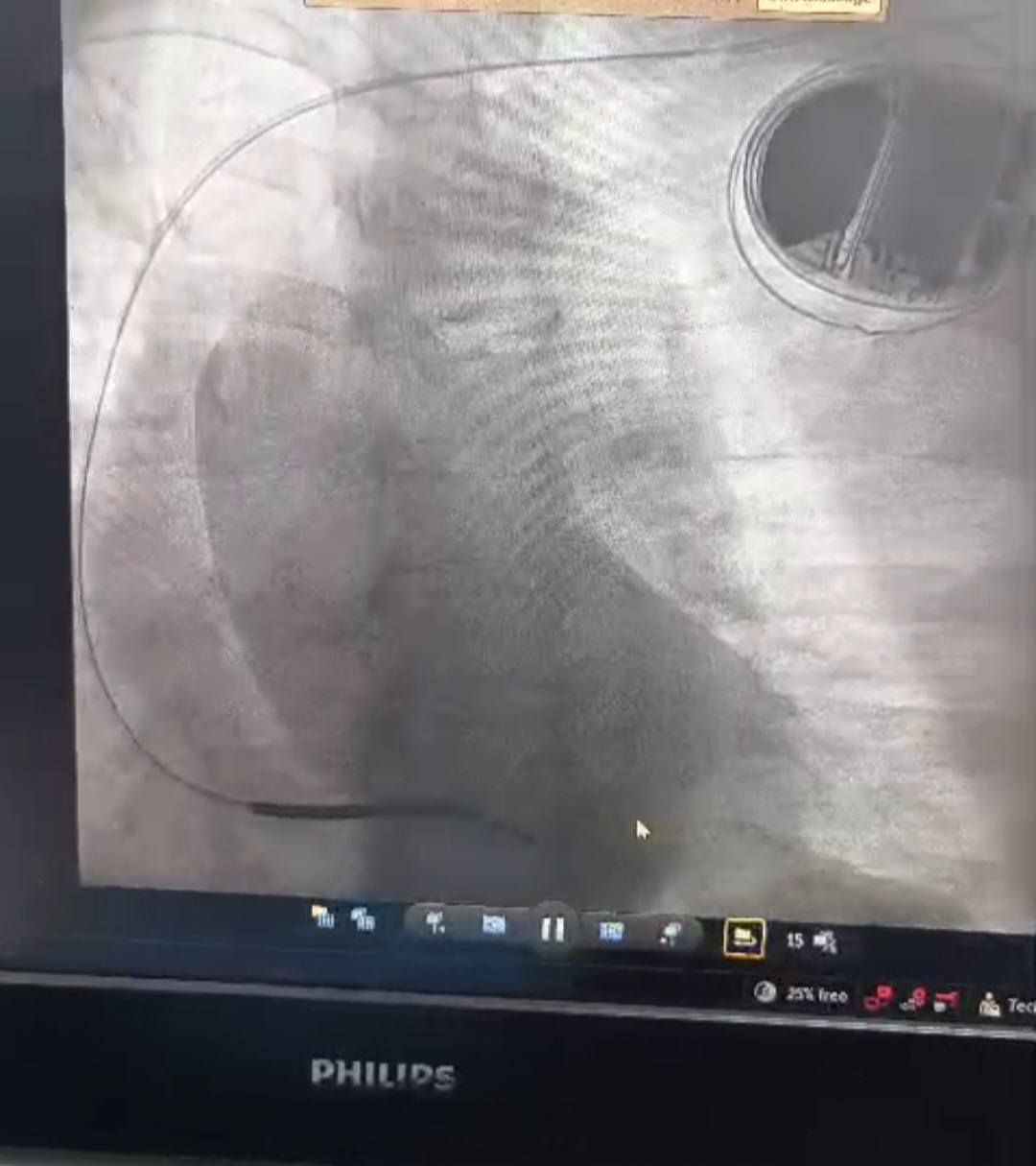 صورة لأشعة المريض