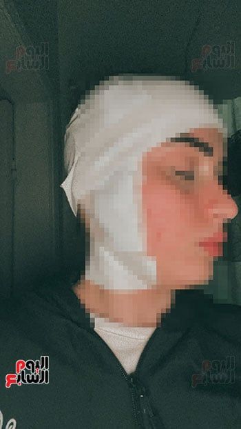 المجني-عليها-عقب-إسعافها المجني-عليها-عقب-إسعافها