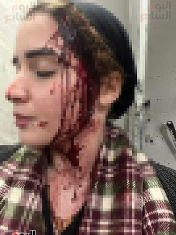 المتهم-شوه-وجهها-بسلاح-أبيض المتهم-شوه-وجهها-بسلاح-أبيض