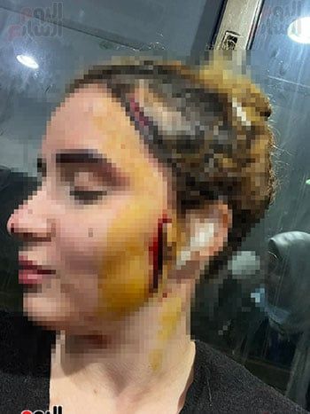 المجني-عليها المجني-عليها