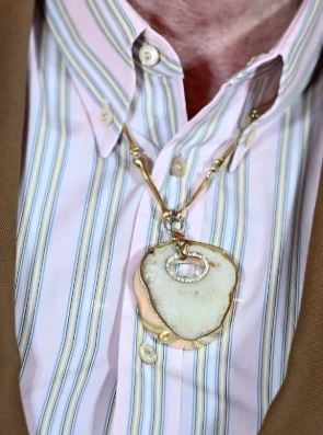 إلتون جون يحول ركبته لعقد