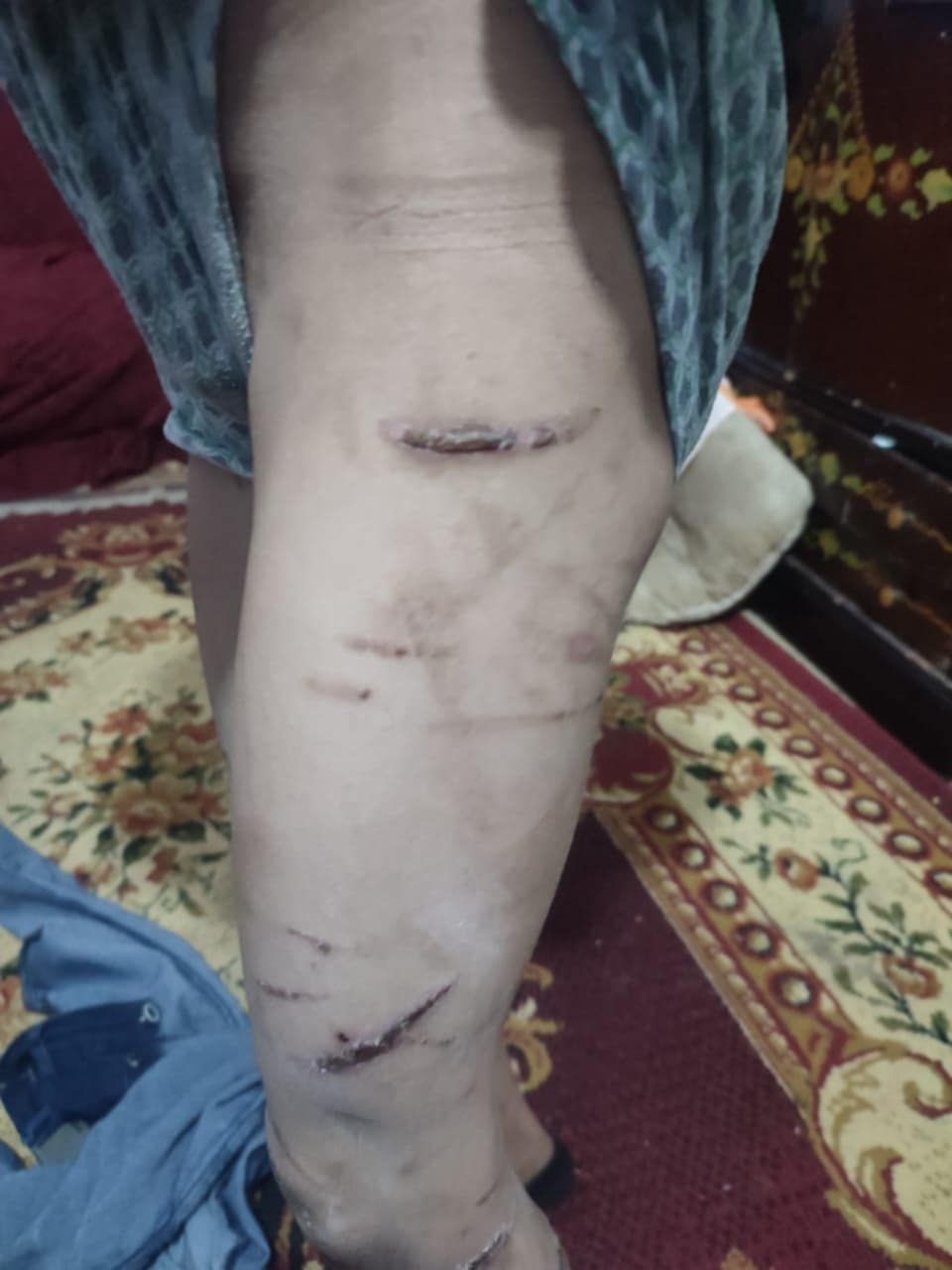 1000346284 1000346284