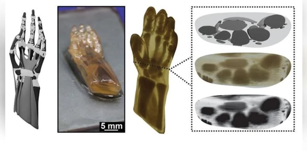 يد مطبوعة طباعة ثلاثية الأبعاد