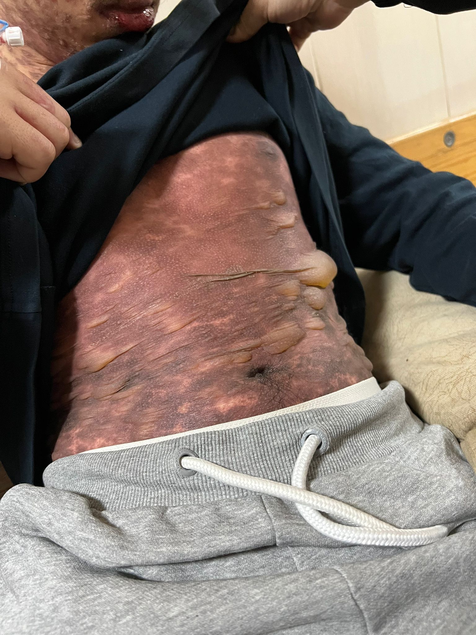 إصابة محمد ضبان