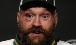 ملك
      الغجر
      يعود
      للحلبة
      وشكوك
      حول
      نزال
      جوشوا