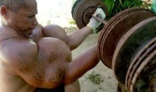 وفاة
باباى
البرازيلى
صاحب
أكبر
عضلات
ذراع
بسبب
حقن
الزيوت..
اعرف
التفاصيل