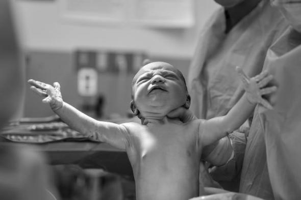 تفسير حلم الولادة بدون ألم في المنام