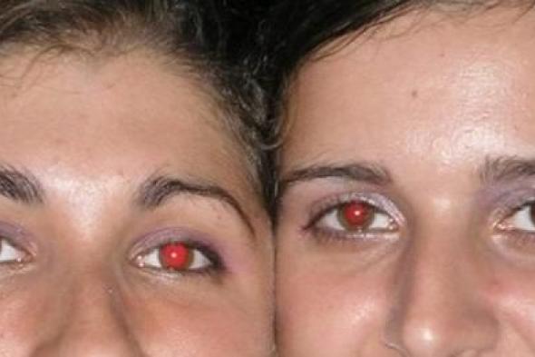 ماذا تعني العين الحمراء في الصور؟.. مفاجأة غير متوقعة
