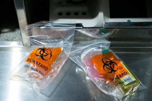 رصد 150 كجم من المواد الغذائية الفاسدة في سكاكا