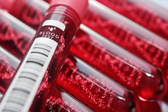 أمراض الدم الوراثية.. "صحة الرياض" توصي باتخاذ سبل الوقاية من المضاعفات
