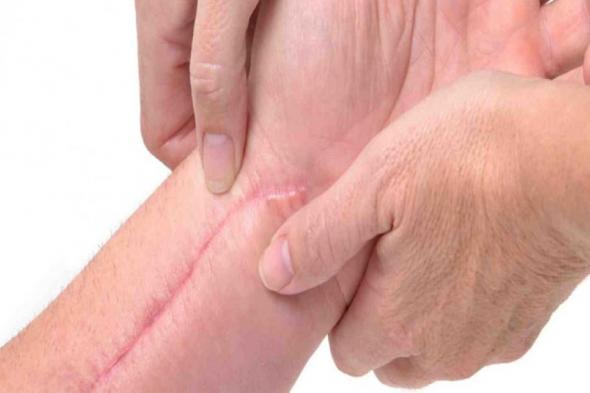 7 طرق فعالة وآمنة للتعامل مع الجروح