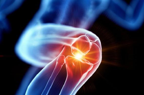 حالة واحدة توجب استشارة الطبيب.. أخصائية علاج طبيعي: 5 حلول فعالة لتخفيف طقطقة الركبة