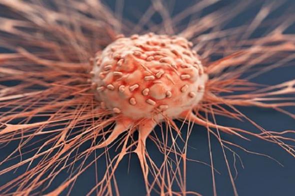 استشاري: 5 أصناف من الأغذية ترتبط علميا بالسرطان