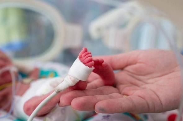 17 نوفمبر اليوم العالمي.. 58 ألف حالة ولادة مبكرة سنوياً في 40 دولة