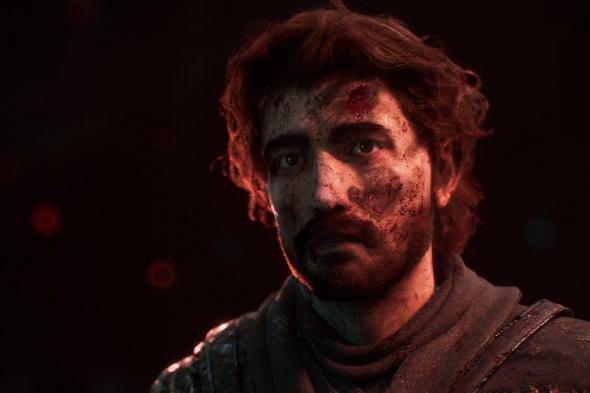 جوائز
Indie
Game
Awards
تحرم
Clair
Obscur:
Expedition
33
من
لقب
لعبة
العام
بسبب
جدل
الذكاء
الاصطناعي
التوليدي