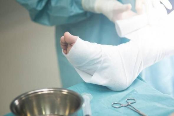 زراعة
      طرف
      اصطناعي
      بالاندماج
      العظمي