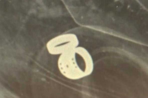 فريق
      طبي
      يعثر
      على
      خاتمين
      باستخدام
      جهاز
      أشعة
      سينية