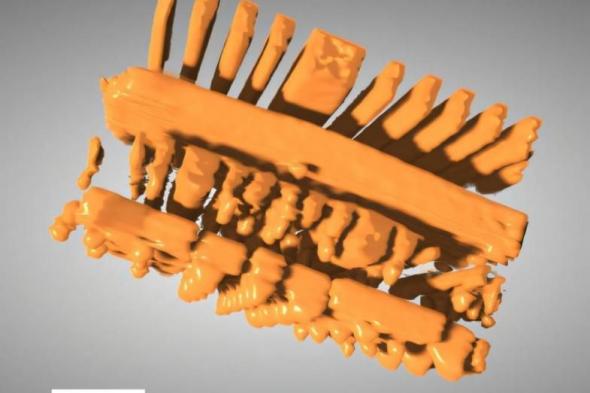 الذكاء
      الاصطناعي
      يحل
      مشكلة
      «البقعة
      العمياء»
      في
      الأشعة
      السينية