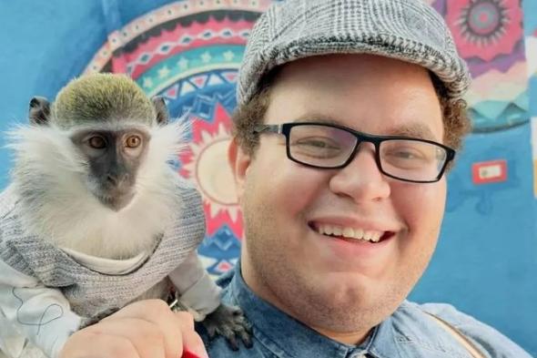 سبب وفاة الفنان محمد الإمام: توقف قلبه 6 مرات