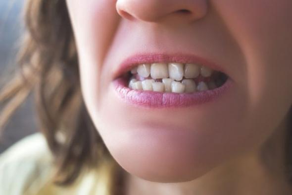 هل أسنانك سليمة ؟ محشوة ؟ مسوسة ؟ الإجابة تقودك لموعد وفاتك