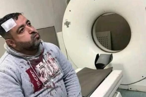 ملثمان
      يعتديان
      على
      صحفي
      أردني
      أمام
      أسرته