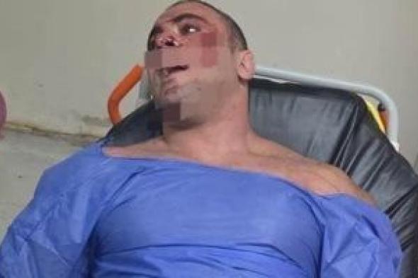 إجراء
جديد
من
النيابة
بعد
قرار
إخلاء
سبيل
المتهم
بإطلاق
النار
على
محمد
الديزل