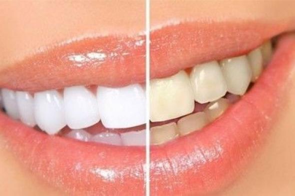أسرار تبييض الأسنان في المنزل بمكونات بسيطة جداً