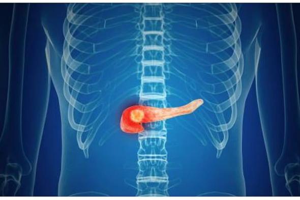 فهد
    الطبية
    توضح
    أعراض
    سرطان
    البنكرياس
    وطرق
    علاجه