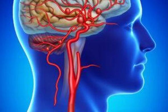 «فهد
    الطبية»
    توضح
    أعراض
    تمدد
    الأوعية
    الدموية
    الدماغي
    وعوامل
    خطر
    الإصابة
    به
