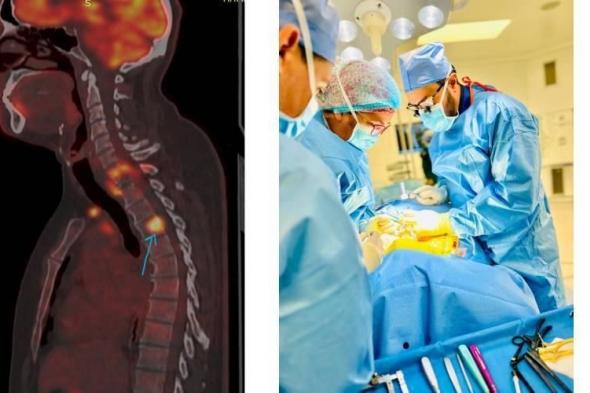 فريق
      طبي
      بدبي
      يستأصل
      أوراماً
      معقدة
      من
      الفقرات
      العنقية
      لشاب