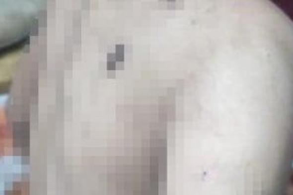 قلب
حجر
وسلخانة
تعذيب..
زوجة
أب
تحول
حياة
طفل
زوجها
فى
الفيوم
إلى
جحيم