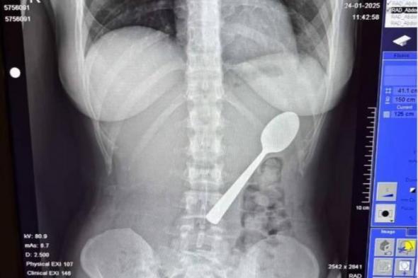 بلجيكية
      تبتلع
      ملعقة
      طولها
      17
      سم