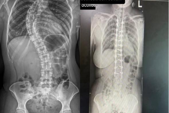 «المستشفى
      السعودي
      الألماني»
      ينهي
      معاناة
      مريضة
      بعد
      30
      عاماً