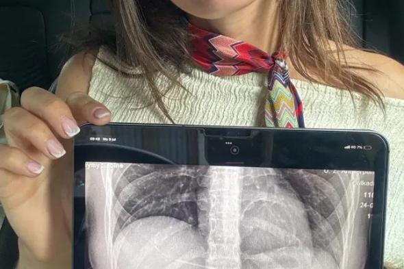 امرأة تبتلع ملعقة طعام بعد أن قفز كلبها فجأة إلى حضنها