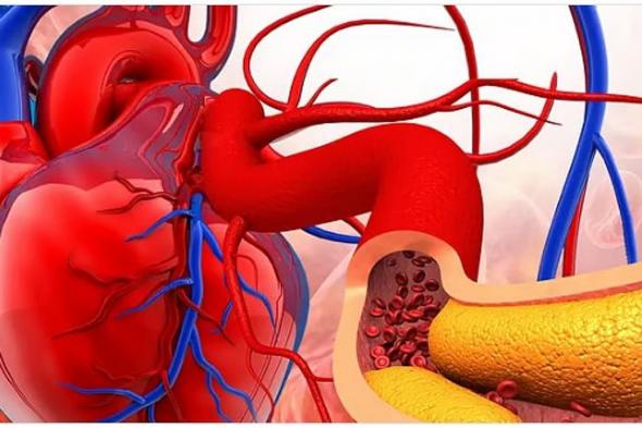 الخضيري
    يوضح
    أسباب
    تصلب
    الشرايين
    وطرق
    الوقاية